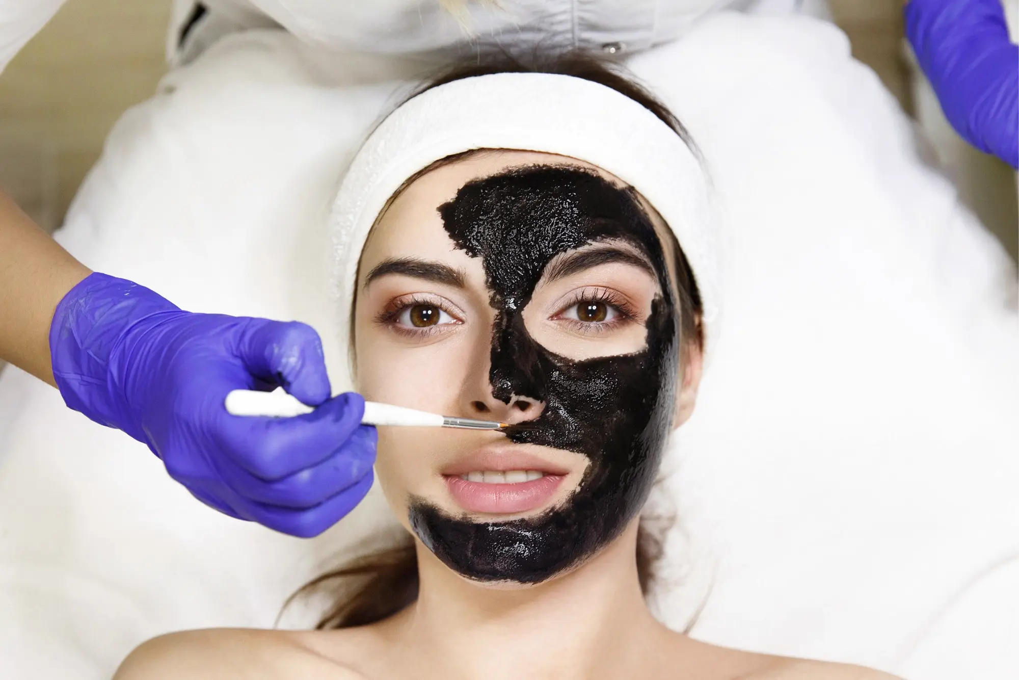 Black Peel